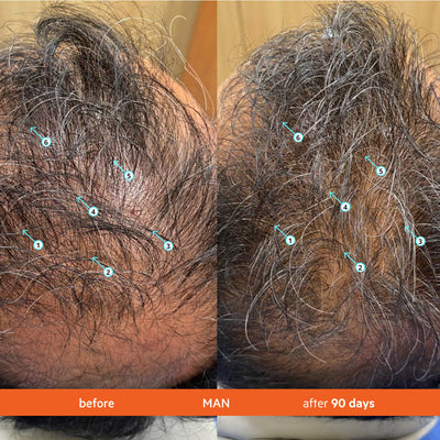 Advanced Hair Growth