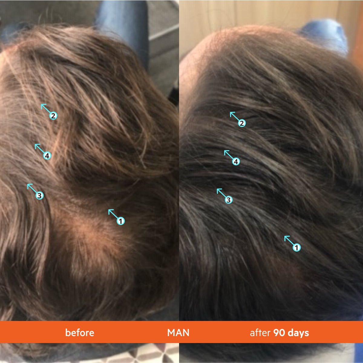 Advanced Hair Growth