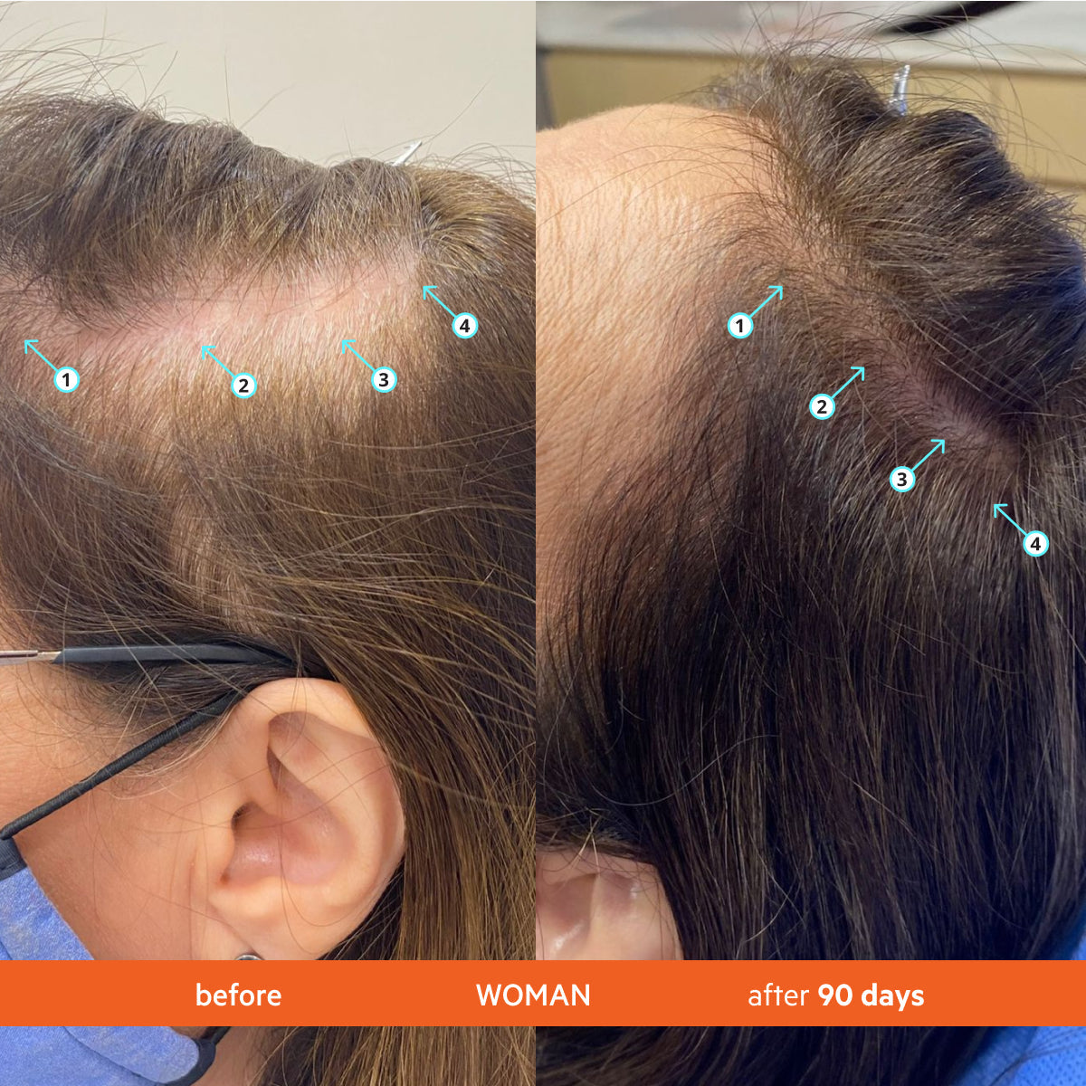 Advanced Hair Growth